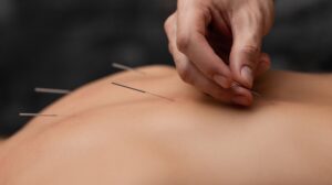 Can I Study Acupuncture While Working Full-Time?