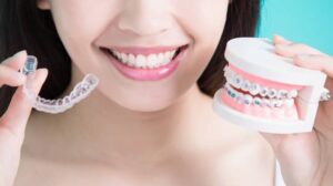 Braces vs. Aligners: Comparing Costs, Comfort, and Treatment Duration